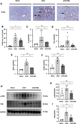 Renoprotective Effects of Maslinic Acid on Experimental Renal Fibrosis in Unilateral Ureteral Obstruction Model via Targeting MyD88